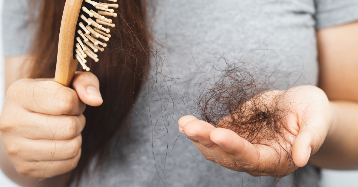 Naturopathic Approach to Hair Loss By: Dr. Kristy Lewis ND